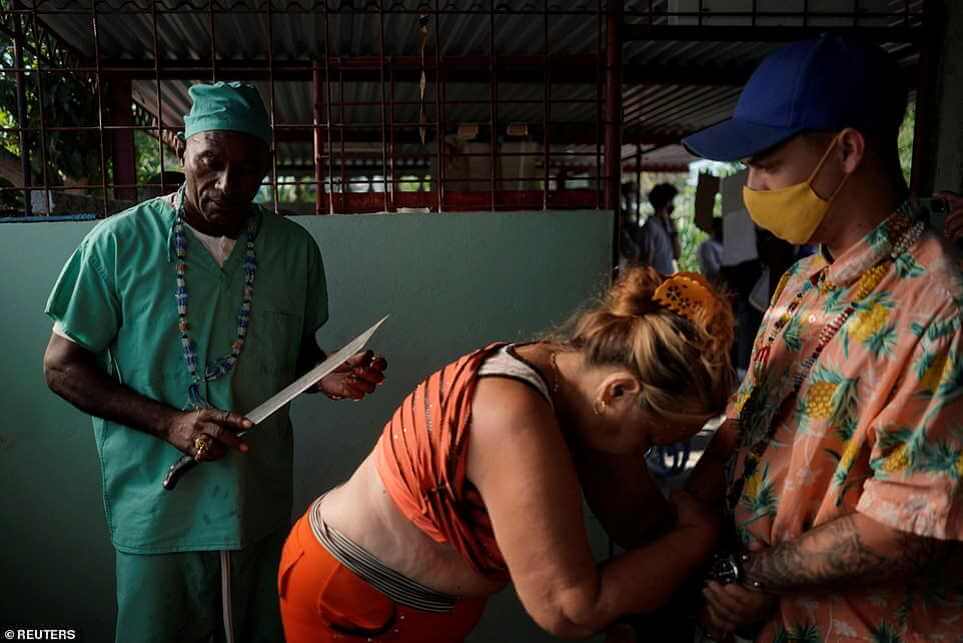 Un «guérisseur» cubain effectue des interventions chirurgicales avec une machette