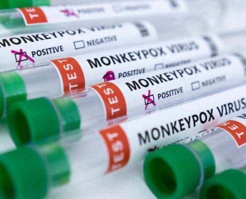 Second case of monkeypox identified in Cuba